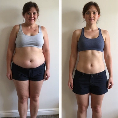 Persona antes del programa de NutriVida Sana